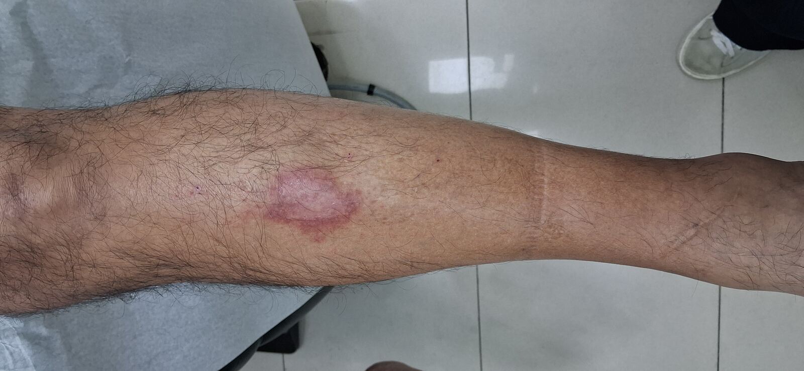 Clinical case: Dermatitis