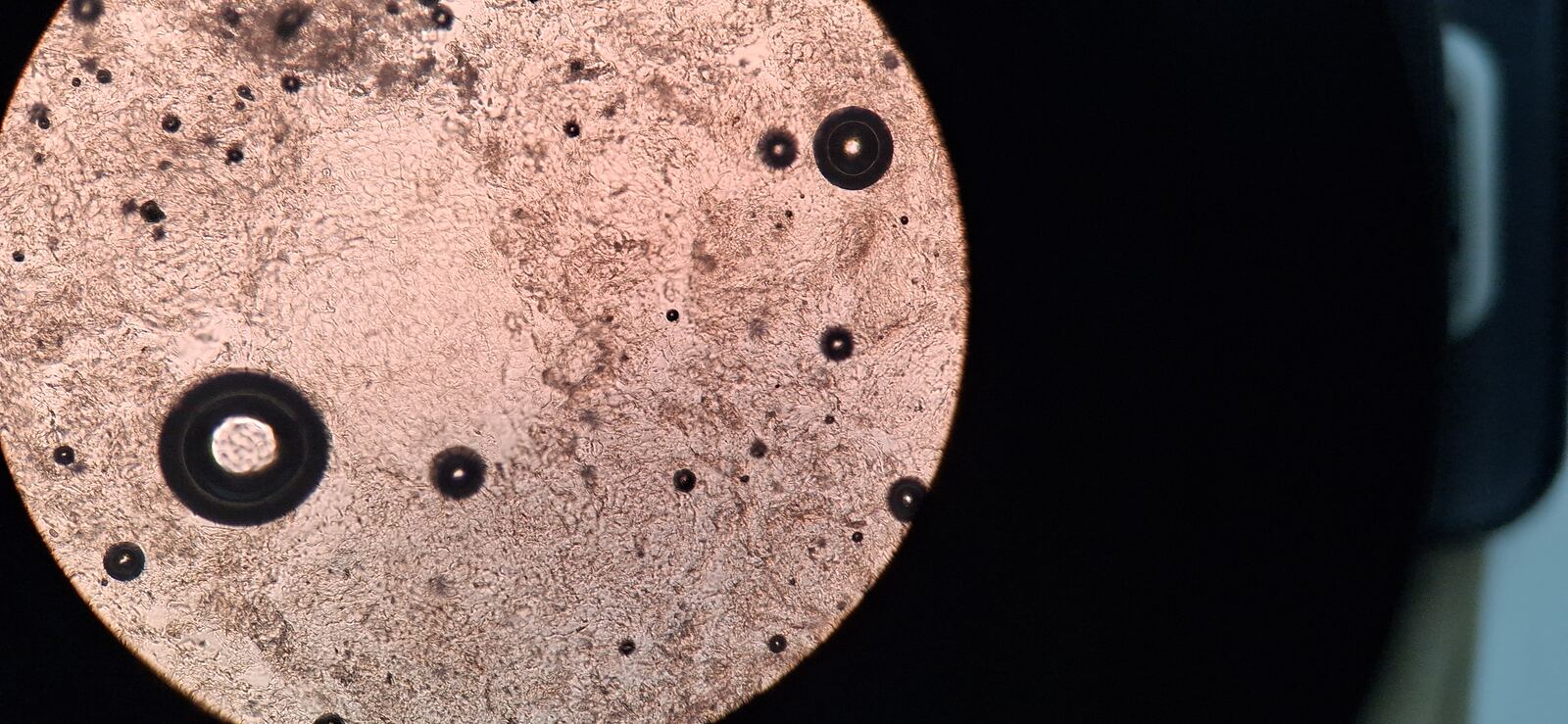 Dyskeratosis: before image