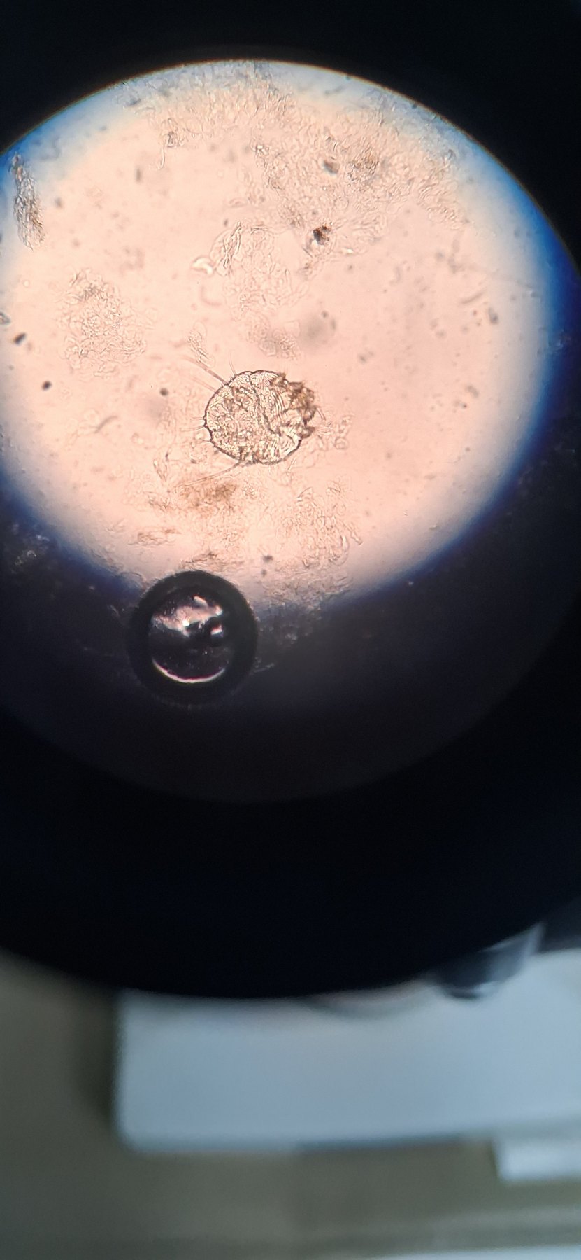 Scabies: before image