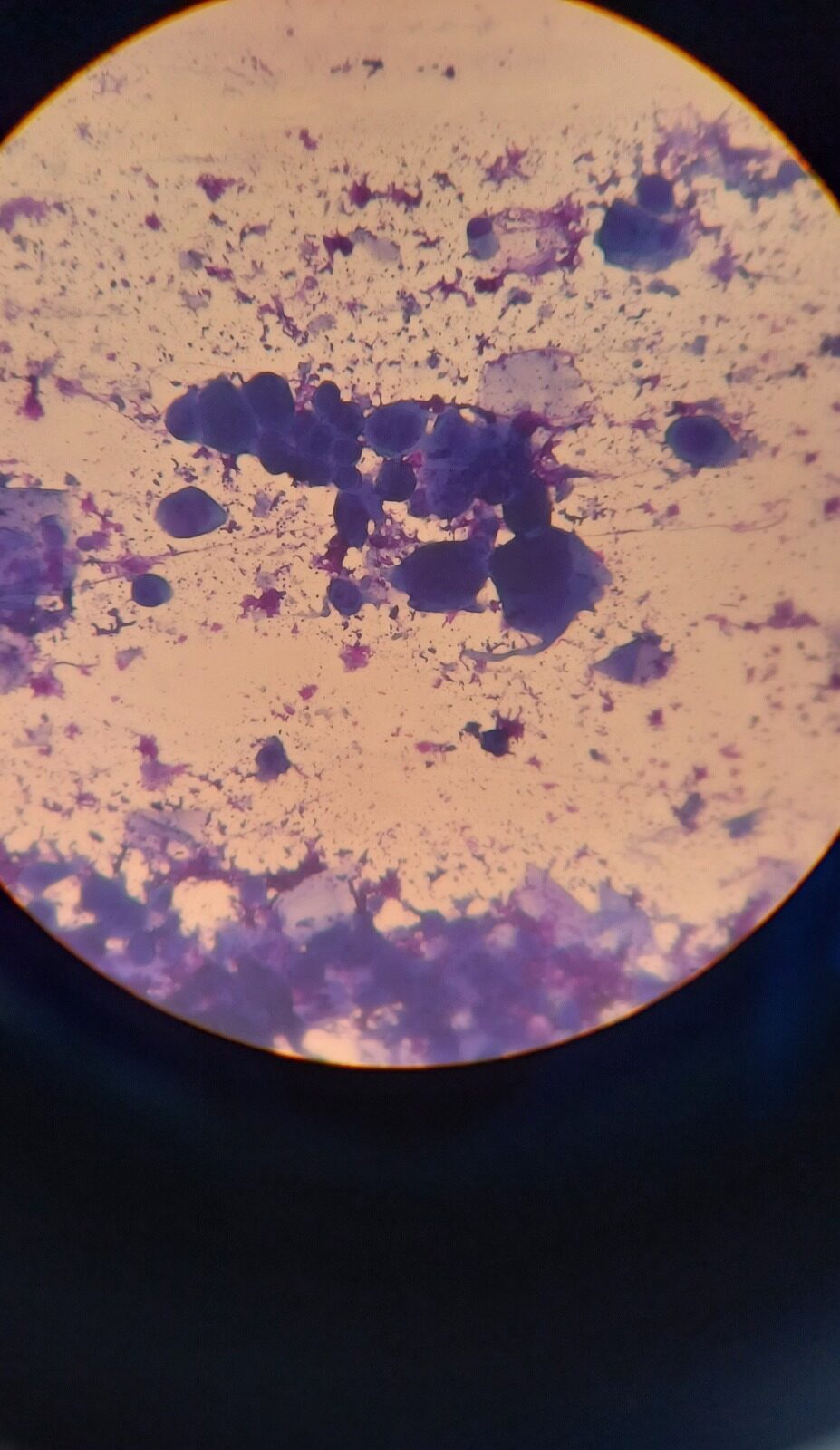 Clinical case: Herpes zoster