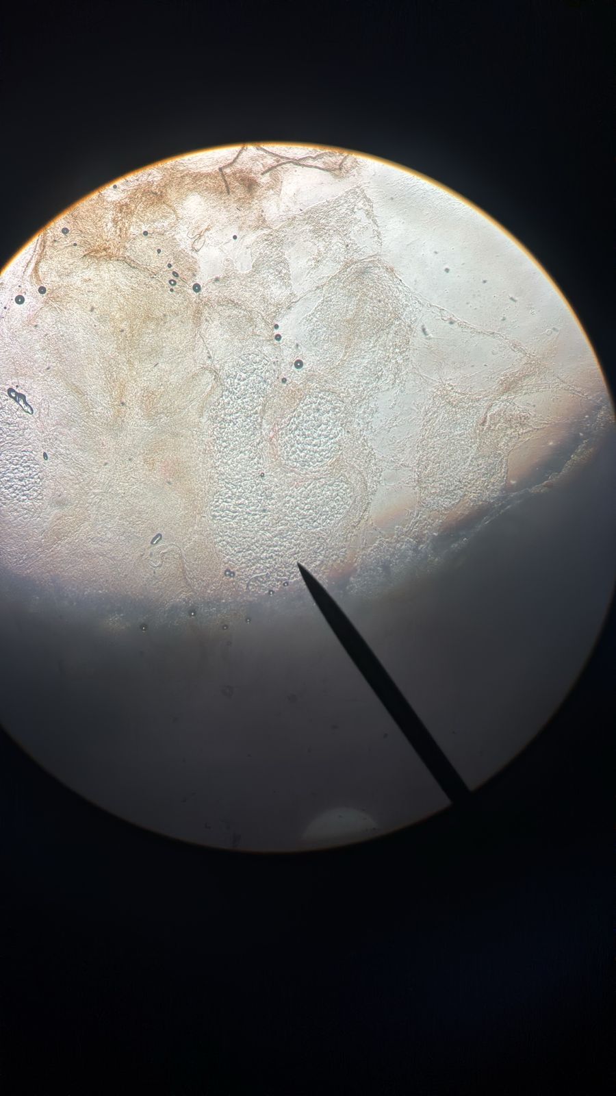 Molluscum contagiosum: before image