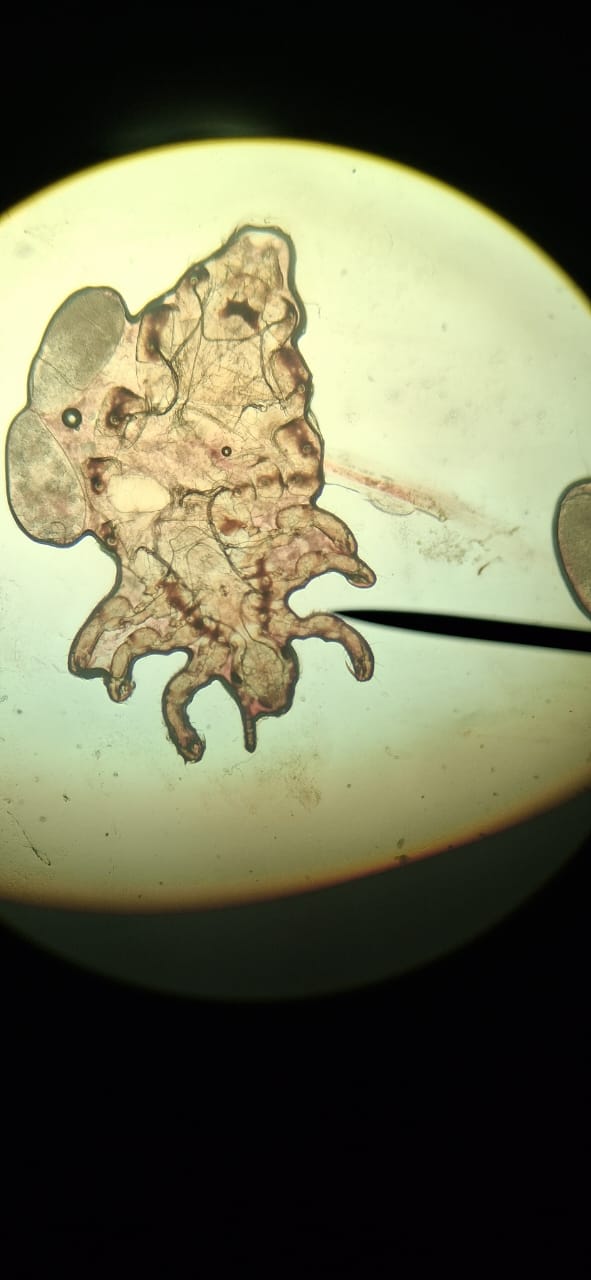 Pediculosis: after image