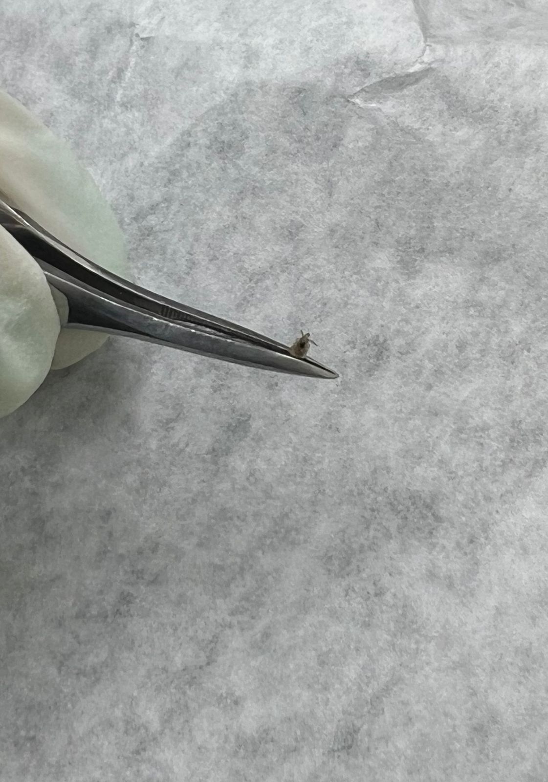 Clinical case of Pediculosis