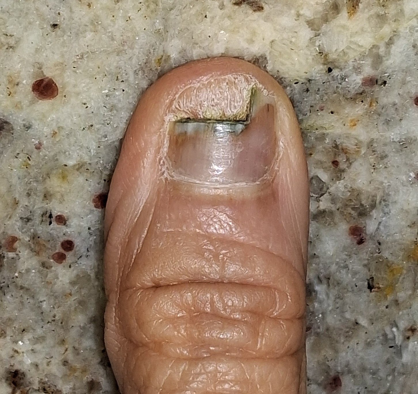 Pseudomonas: before image