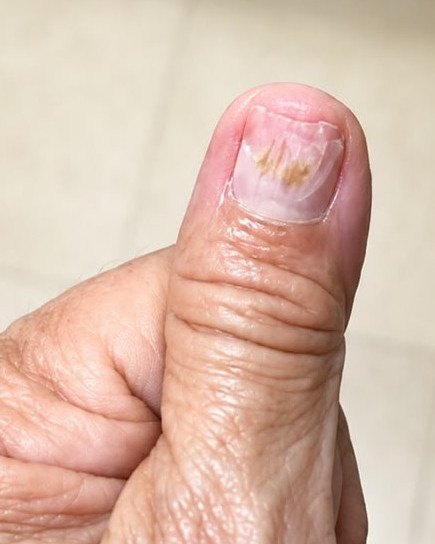 Pseudomonas: after image