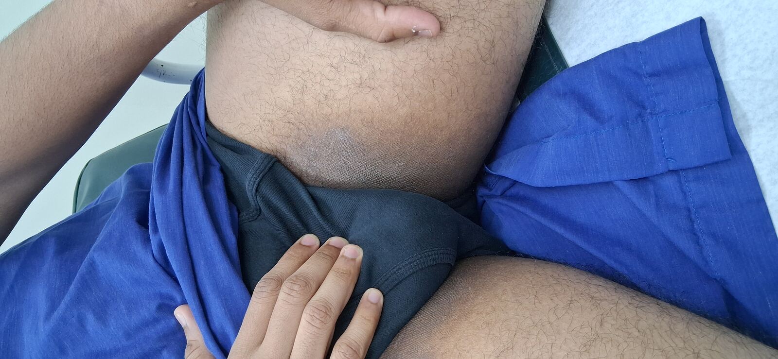 Tinea corporis: before image