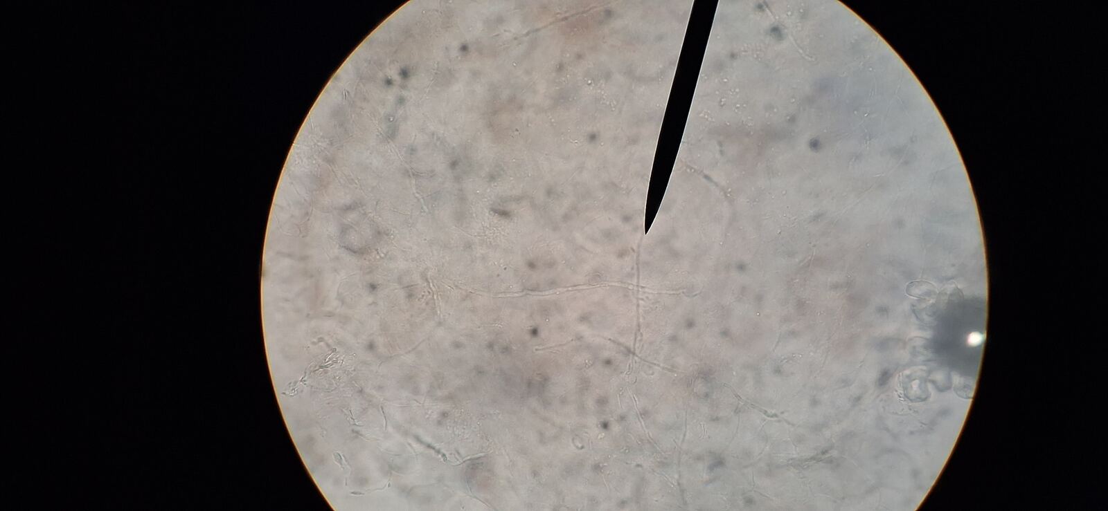 Tinea nigra: after image