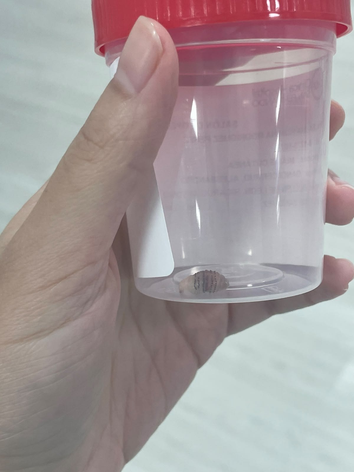 After: Miasis Cutánea ( Larva )