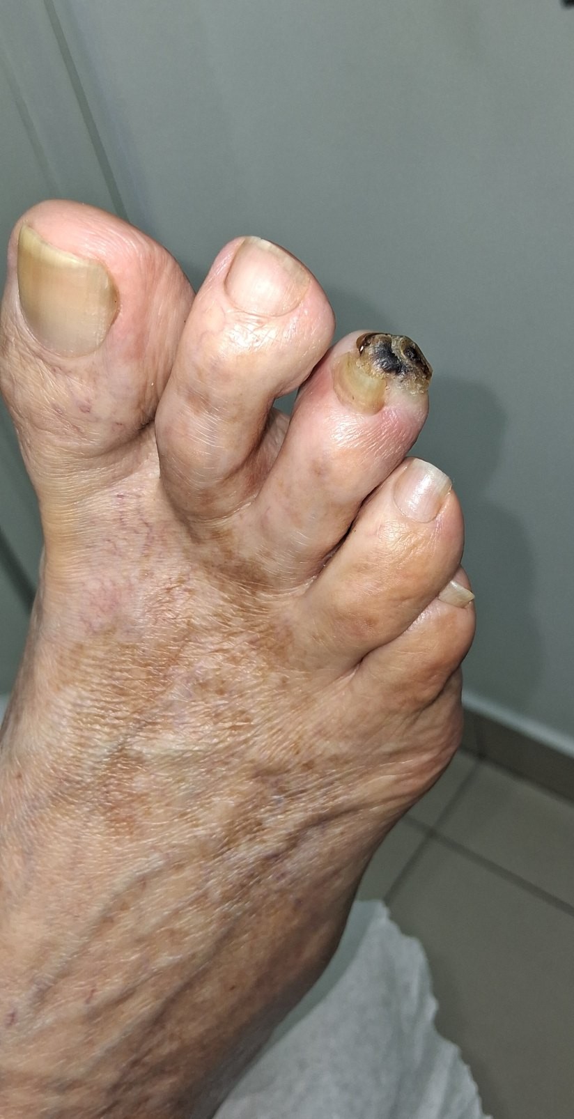 Callo
