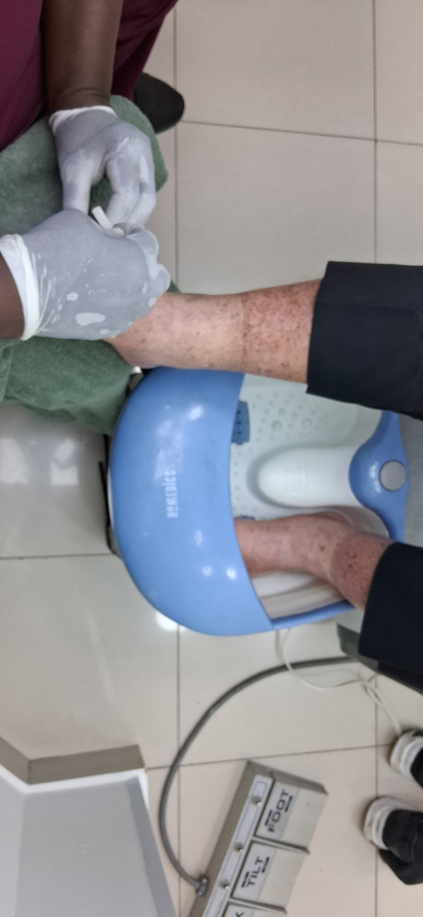 Before: Cuidado de los pies